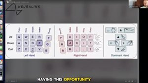 Neuralink-beteg 141 szót/perc sebességgel gépel gondolattal