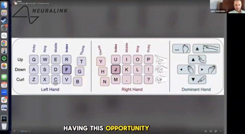 Neuralink-beteg 141 szót/perc sebességgel gépel gondolattal