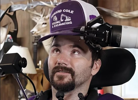 Neuralink páciens gondolattal irányít egy robotkart